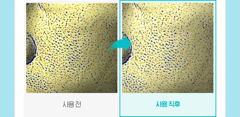 [화잘먹크림] 빌리프 아쿠아 밤 프로즌 크림 50ml 기획 (3종 중 택 1) 상세페이지 25